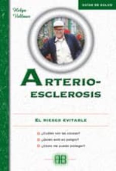 Arterioesclorisis: El riesgo evitable